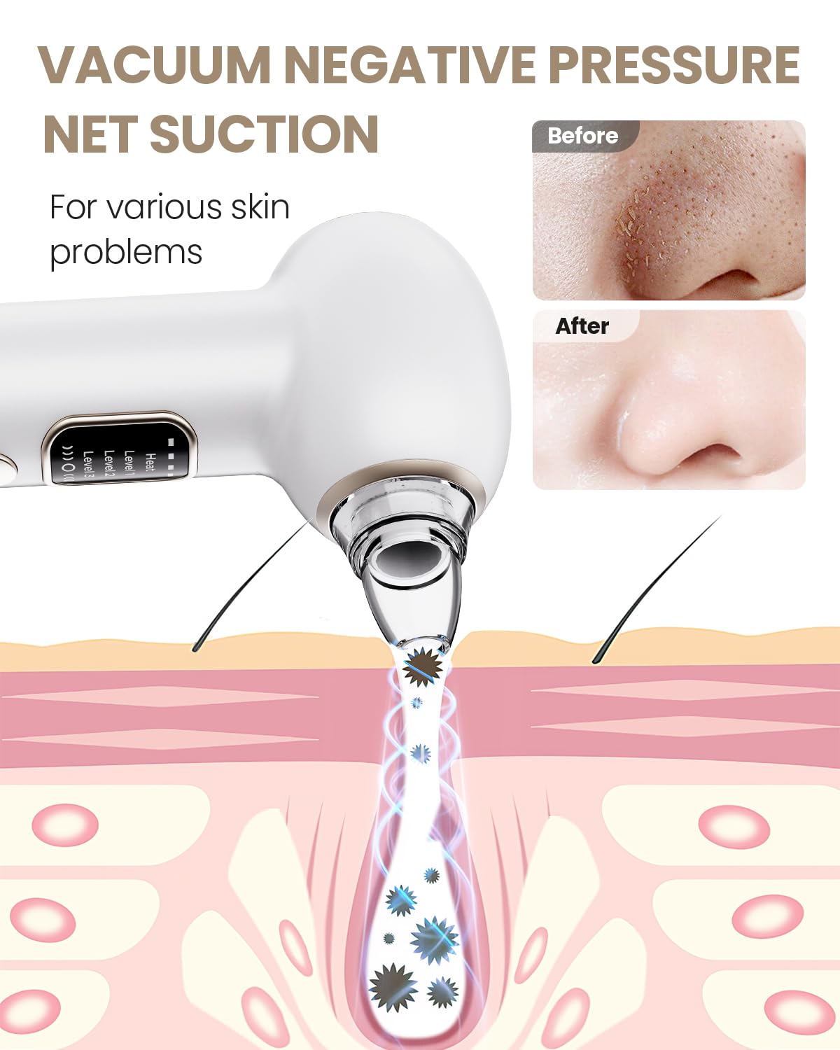 Removedor Para Puntos Negros