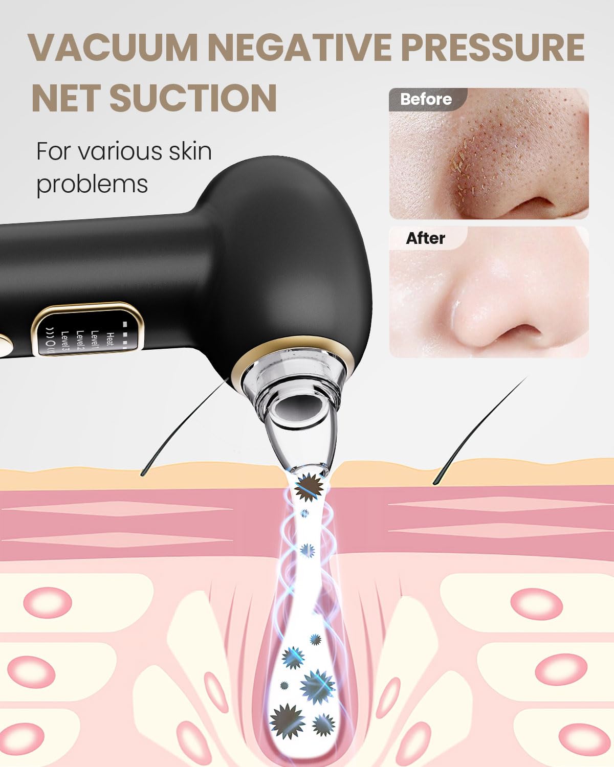 Removedor Para Puntos Negros