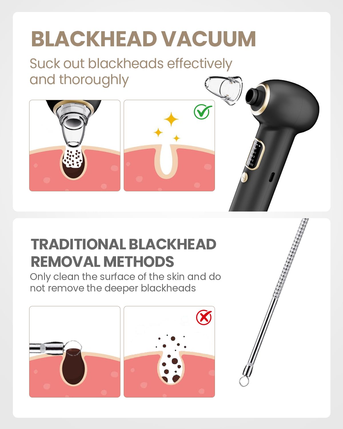 Removedor Para Puntos Negros