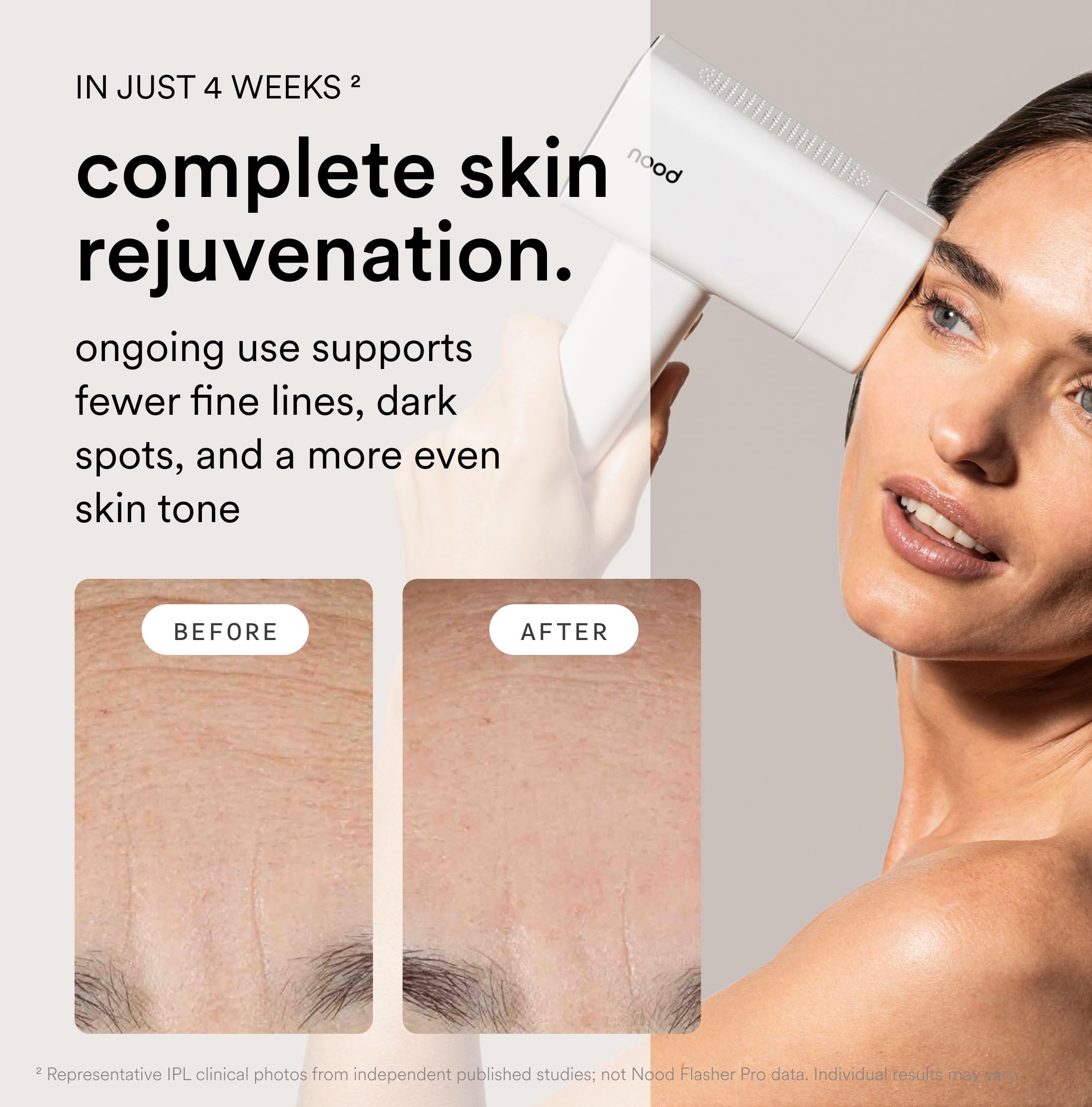 Maquina Depiladora Laser